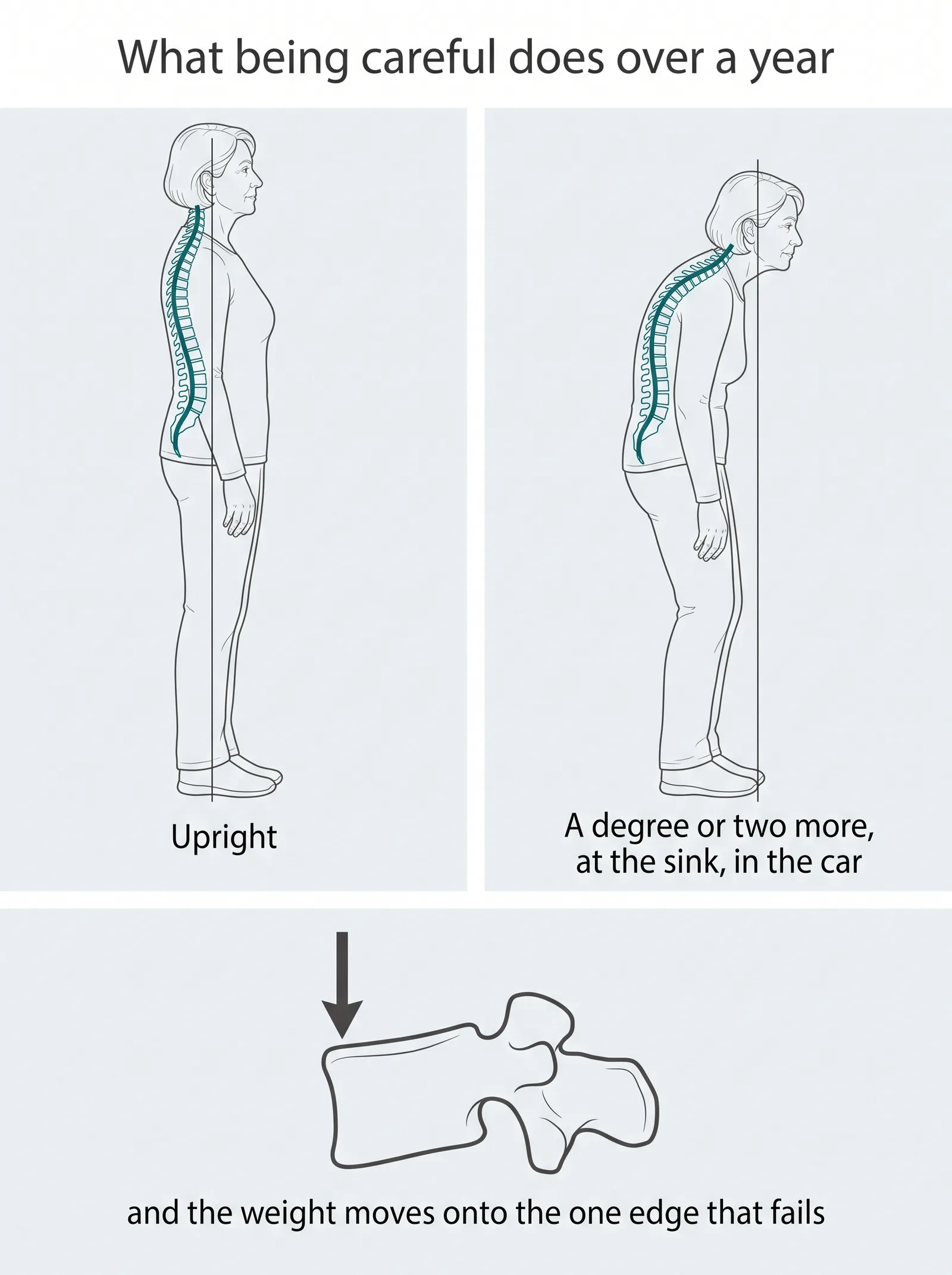 Three panels: standing upright against a reference line, tipped forward a year later, and a vertebra with the load moved onto its front edge.